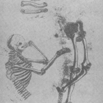 itaki-kemik