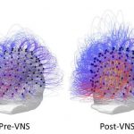VNS-denemesi