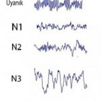 eeg