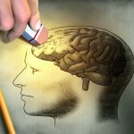 Alzheimer