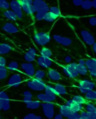 Bipolar Bozukluktaki Ruh Hali Değişimlerinin Nedeni Beyindeki Potasyum Seviyeleriyle İlgili Olabilir