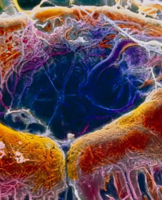 CRISPR Tedavisi İlk Kez Direkt Olarak İnsan Vücuduna Uygulandı