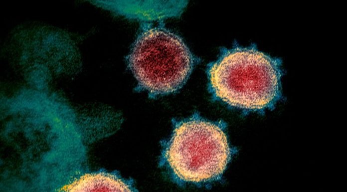 Covid-19'un elektron mikroskopu ile çekilmiş görüntüsü. U.S. National Institutes of Health/AP/Shutterstock