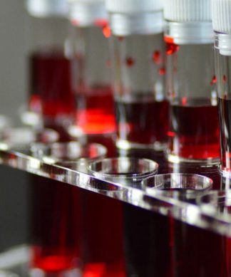 İnsanların Covid-19 Olup Olmayacaklarını Kan Grupları Belirliyor Olabilir