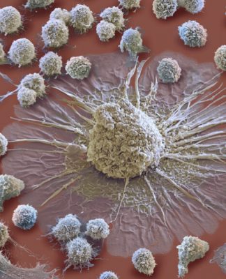 İki Bağışıklık Sistemi Kimyasalı Covid-19’un Ölümcül Sitokin Fırtınalarını Nasıl Tetikliyor?